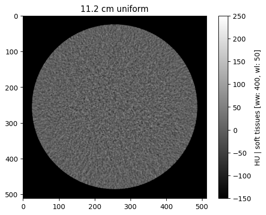 ../_images/notebooks_02_pediatric_denoising_evaluation_11_0.png