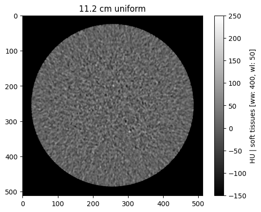 ../_images/notebooks_02_pediatric_denoising_evaluation_25_0.png