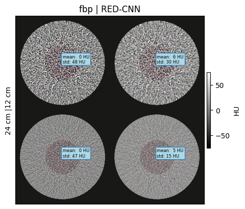 ../_images/notebooks_02_pediatric_denoising_evaluation_27_0.png